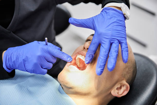 Best Emergency Tooth Extraction in Maysville, OK